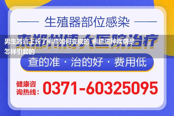 男生器官上长了疱疹如何变成的_疱疹这种疾病是怎样引起的